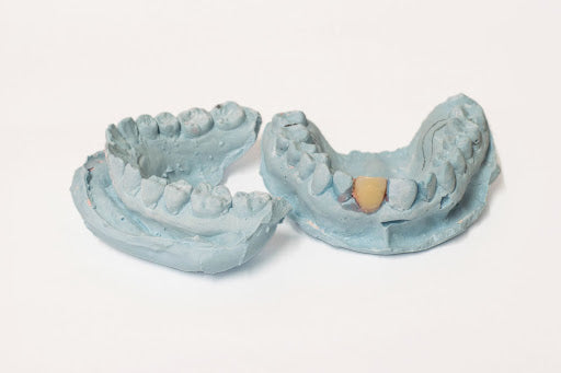 The Importance of Dental Molds: A Guide to Oral Health