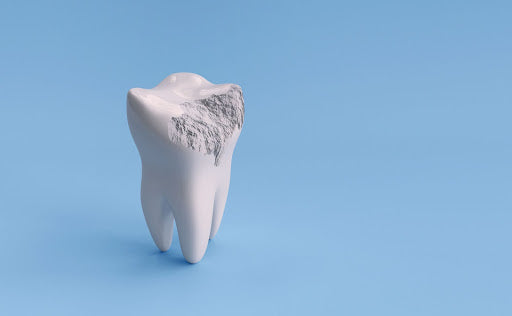 Protecting Your Smile: Tooth Abrasion Versus Attrition and How to Handle Both