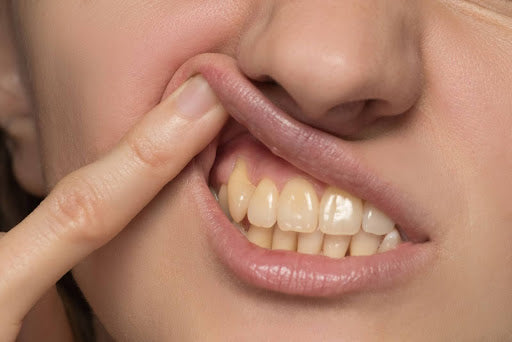 8 Signs Your Teeth Are Shifting