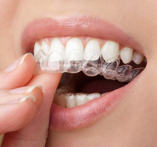 Can You Wear a Night Guard With Veneers?